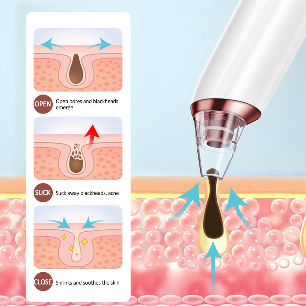 Изображение товара: Средство для очистки пор, удаления черных точек на лице, глубокое T-образное Удаление прыщей и акне, вакуумное всасывание, Алмазный уход за лицом, спа, Очищение лица