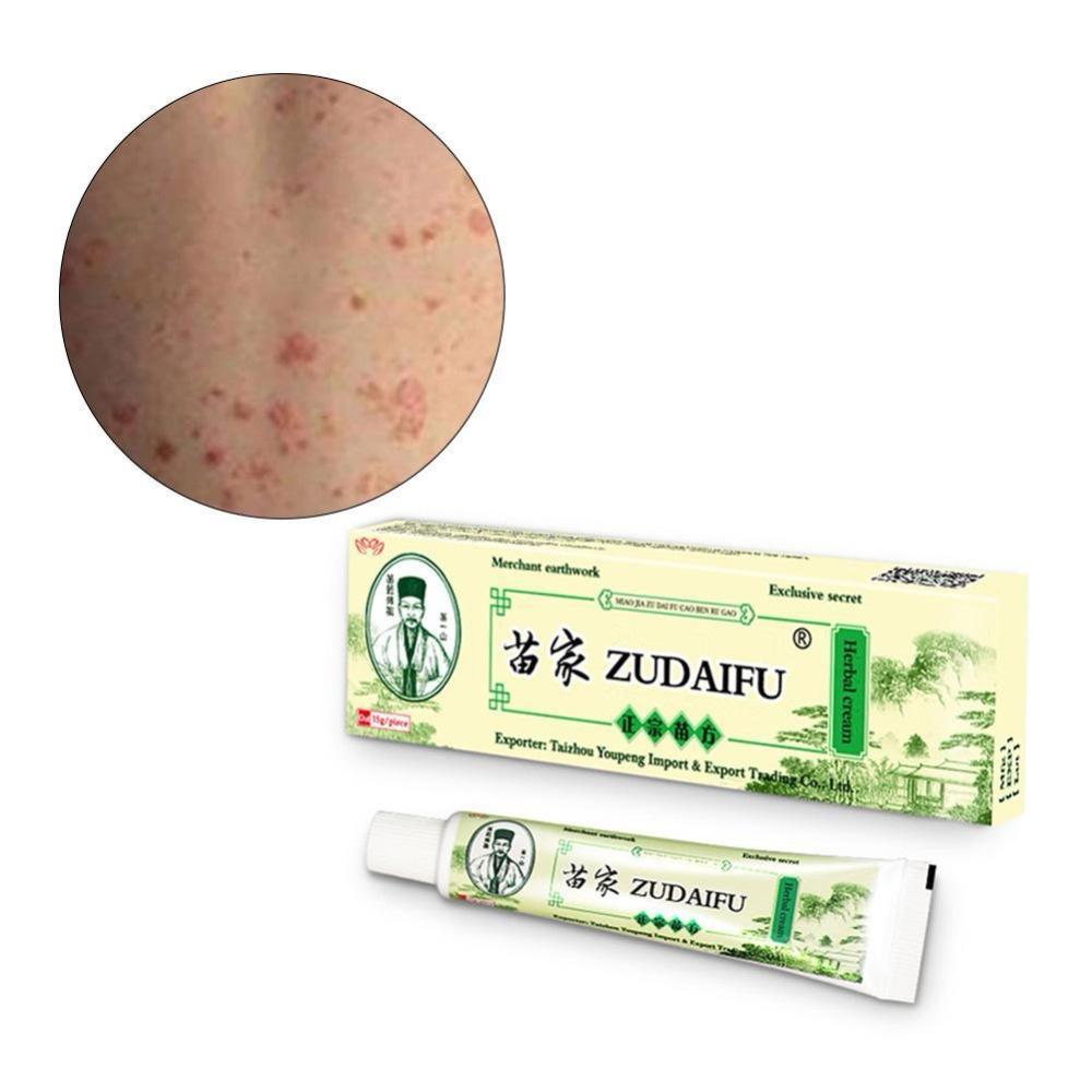 Изображение товара: Крем Zudaifu для ухода за кожей от псориаза, мазь для лечения дерматита, экзематоида, экземы, крем от псориаза (без коробки)