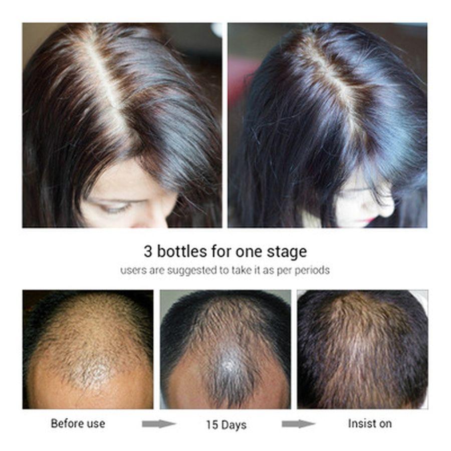 Изображение товара: Эссенция для роста волос, спрей, лечение кожи головы, питание, сыворотка для роста Ginge с эфирным маслом, восстанавливающая маска для волос, товары для ухода за волосами