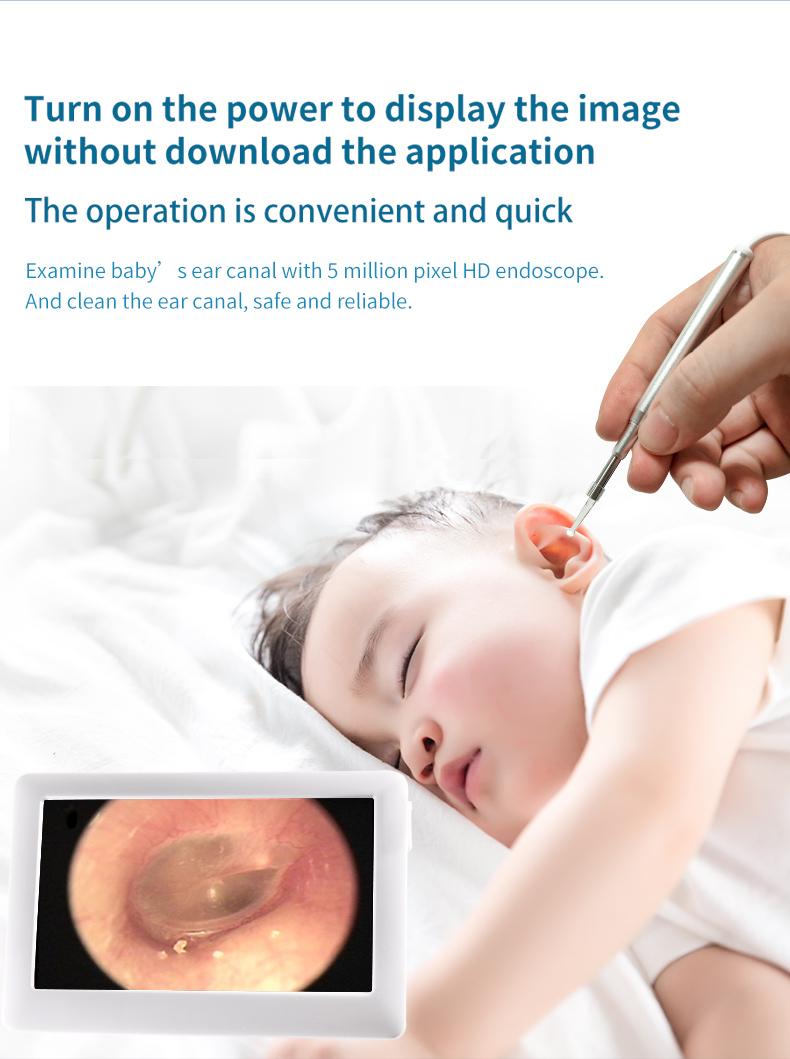 Изображение товара: Визуальная ложка для чистки ушей, отоскоп, объектив 3,9 мм, светодиодный эндоскоп с ЖК-дисплеем 4,3 дюйма, ушной Пинцет медицинская эндоскопическая камера