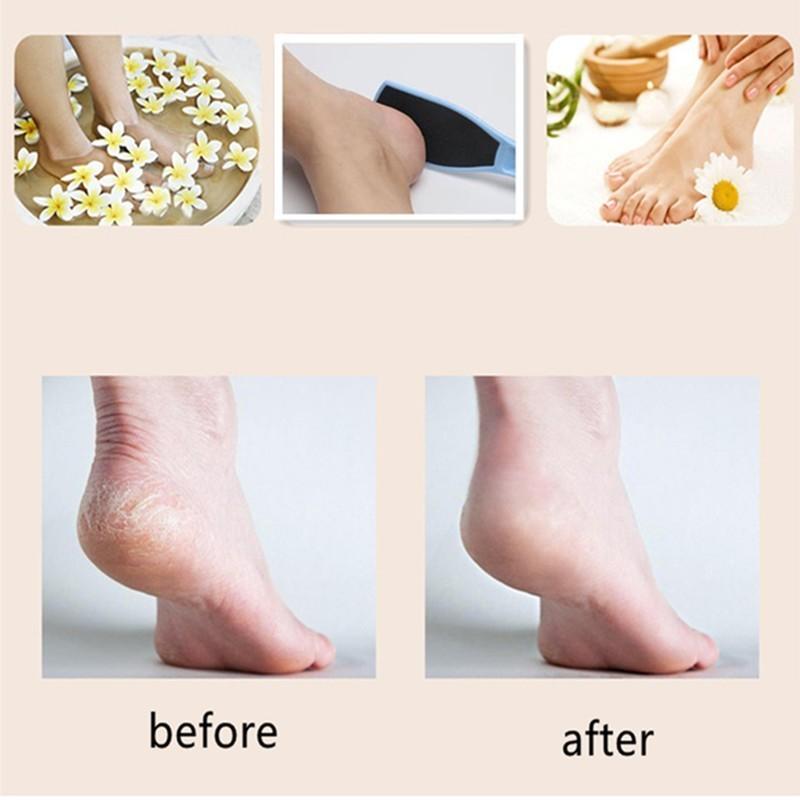 Изображение товара: Двухсторонний пластиковый Педикюр Рашпиль для ног, пемза для ухода за ногами, педикюр, пилка для ног, жесткая отбеливающая кожа, средство для удаления мозолей