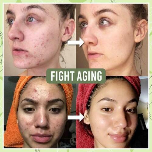 Изображение товара: Green Tea Cooling Cleansing Mud Mask Anti-acne Face Cream Shrink Pores Acne Blackheads Removal Cream Essence Skin Care 100g