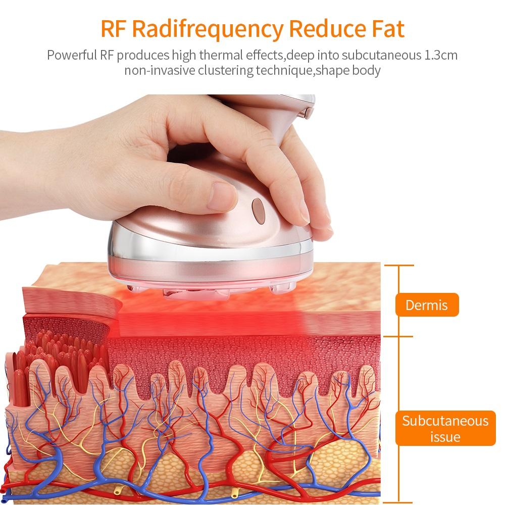 Изображение товара: Высокочастотный кавитационный массажер для похудения, ультразвуковое устройство для сжигания жира, потери веса, вибрирующее устройство для омоложения кожи с красным фотоном