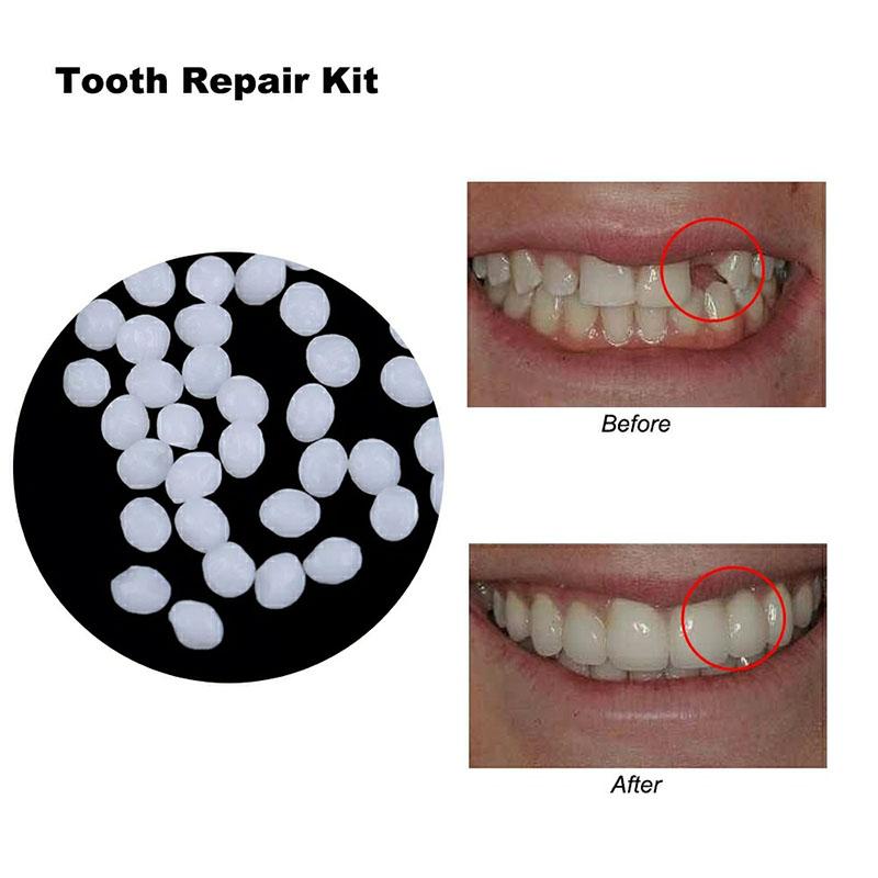 Изображение товара: Резиновый твердый клей для временного ремонта зубов, 10 г